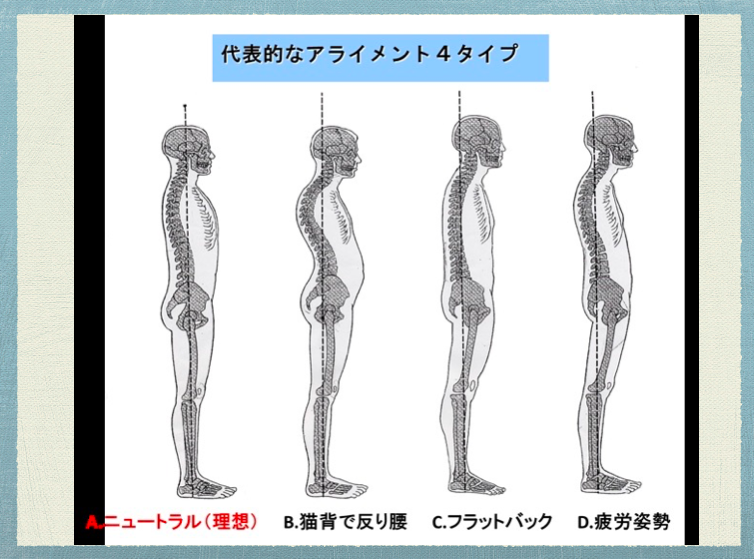 むち打ちのストレッチ法 5選 を紹介 山梨県甲府市の 整体院 整骨院信玄 腰 膝 肩痛に人気